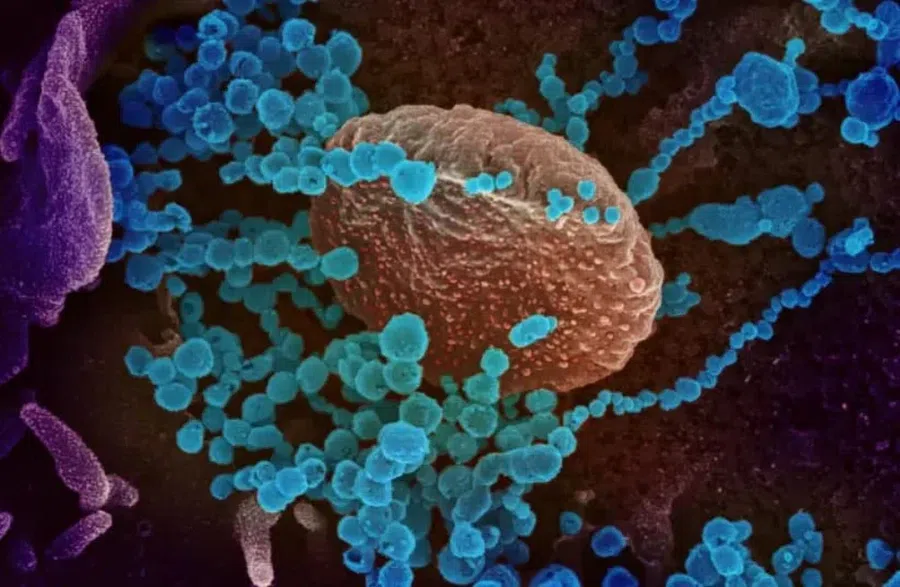 Как убить коронавирус за две секунды, придумали ученые: Радиоволны уничтожают ковид