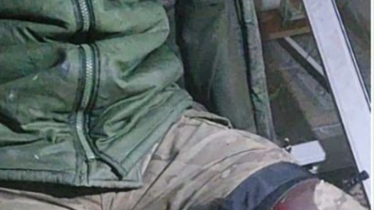Родным Алексея Мотуза прислали фото его раненого в ногу, а затем мертвого. 
Фото: t.me/MilitaryCriminal