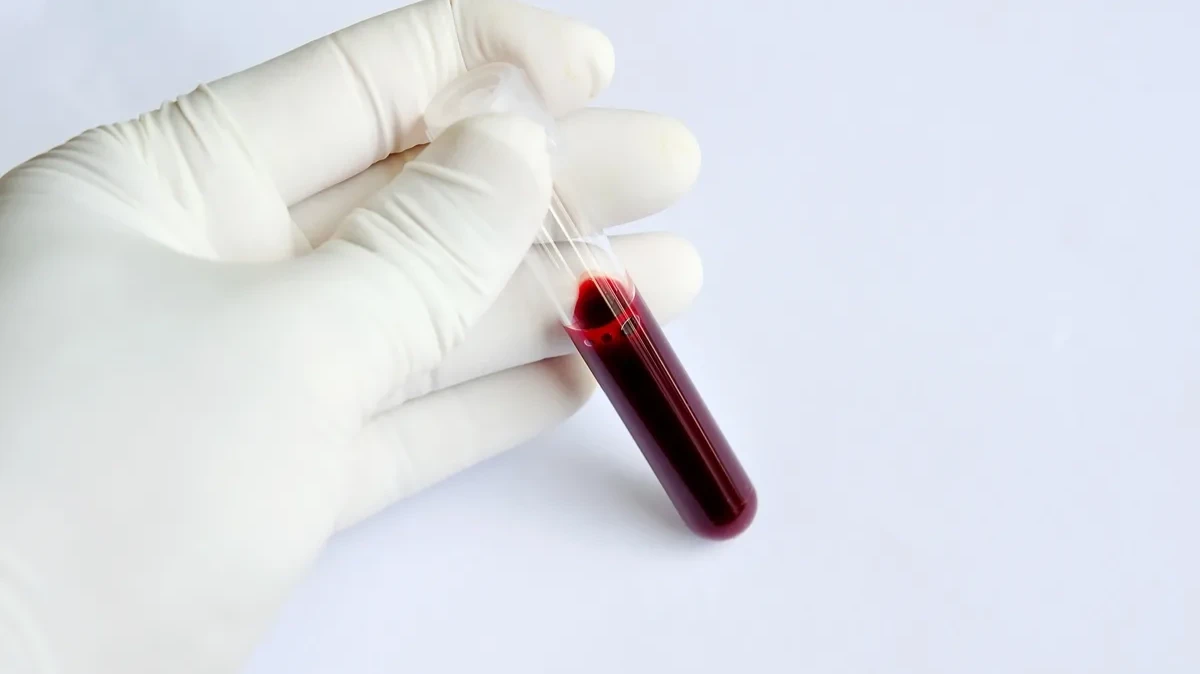 Группа крови может многое рассказать о человеке. Фото: pxhere.com