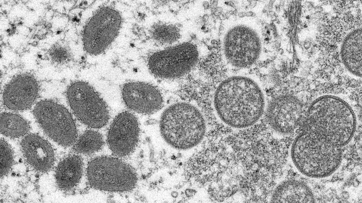 Вирионы оспы обезьян (слева), полученные из образца кожи человека. Фото: CDC/AP. 