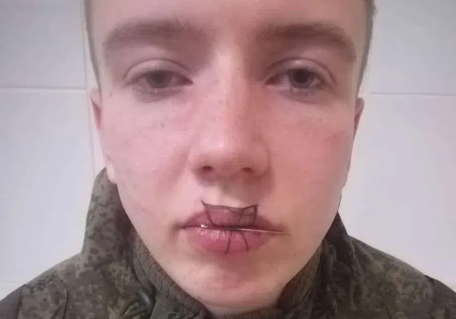 Солдат-срочник зашил себе рот после ссоры с девушкой в одной из частей на Урале