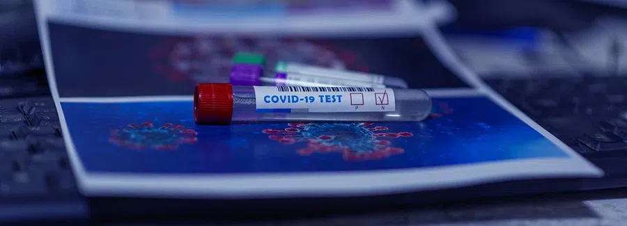 Минздрав назвал истинное число пациентов с коронавирусом в тяжелом состоянии в ковидном госпитале Бердска