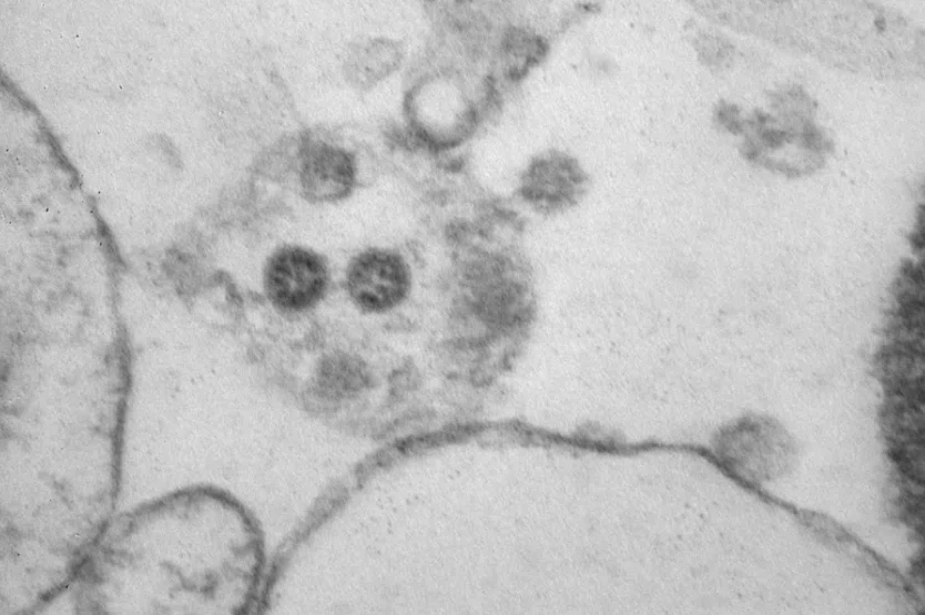 Центр «Вектор» обнародовал новые снимки штамма коронавируса «омикрон»