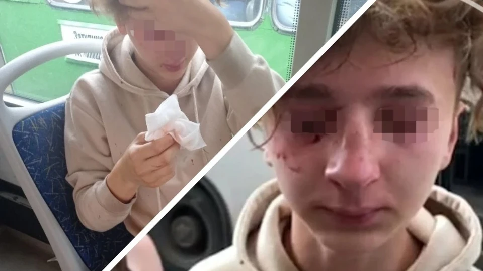 «Я тебе очки вобью в лицо, клоун»: В Новосибирске следователи проверят сибиряка, избившего 15-летнего подростка в автобусе из-за внешности
