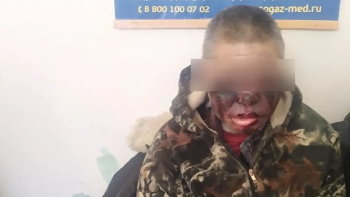 Трое жителей Хабаровского края пострадали от обморожения