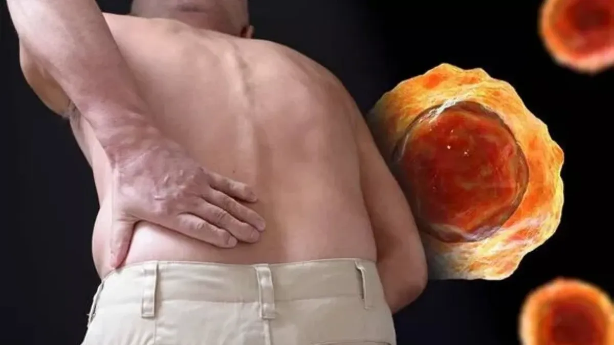 Боль в спине иногда является симптомом рака. Фото: GETTY