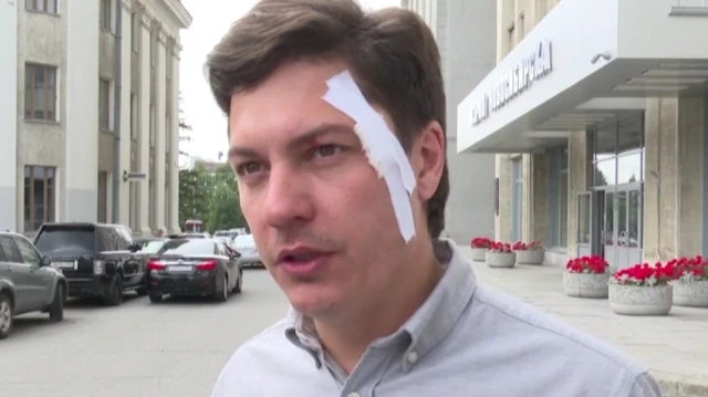 Вице-мэр Новосибирска Скатов заявил, что спецназ жестко ворвался в его кабинет для обысков. Удар силовиков пришелся по виску