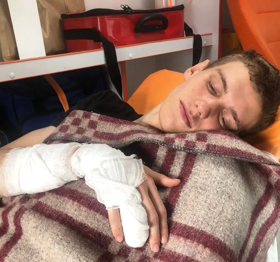 «Кожа прикипела к одежде»: Обожженного при ударе током в Бердском лесхозе 18-летнего Алексея Симона увезли в ожоговый центр