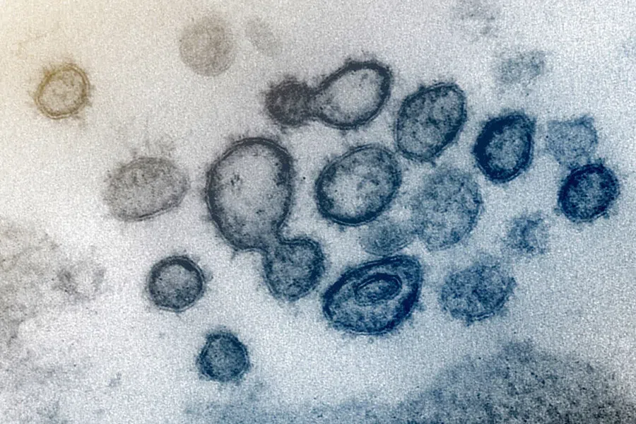 Иммунная память становится хуже после тяжелой формы коронавируса