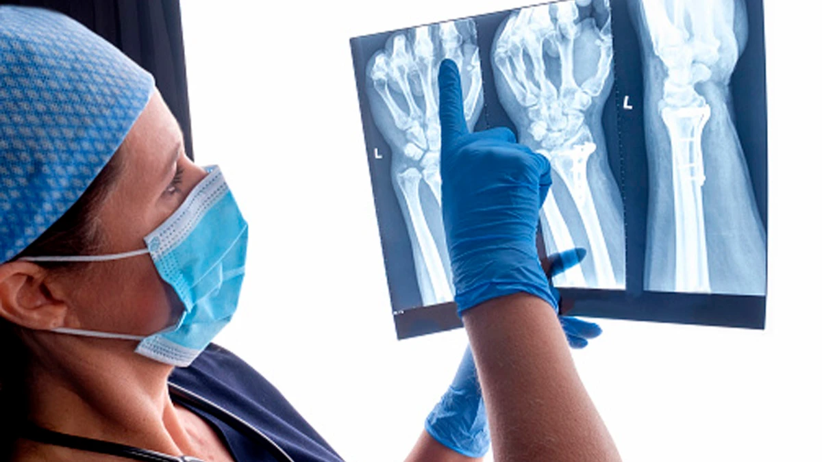 Доза излучения при рентгене настолько мала, что вряд ли моментально спровоцирует ожог или рак. Фото: Pixabay.com
