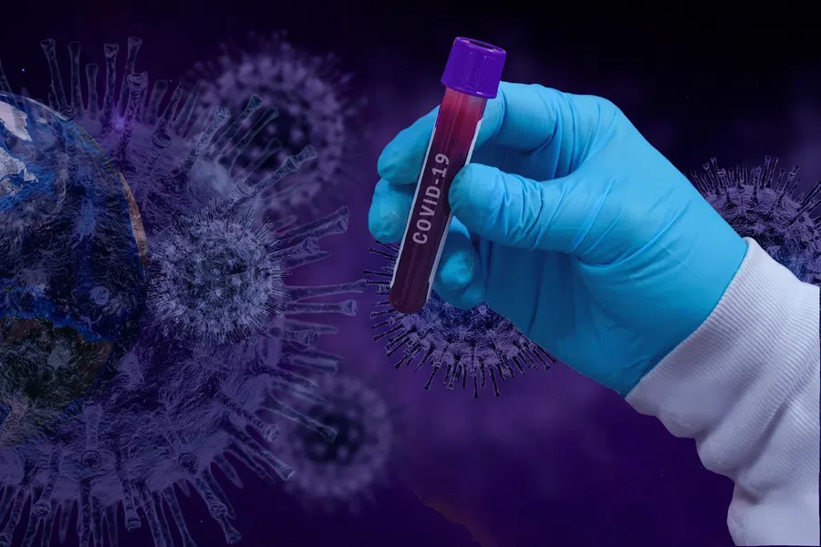 Вирусолог объяснила причину прекращения производства вакцины против коронавируса «ЭпиВакКорона»