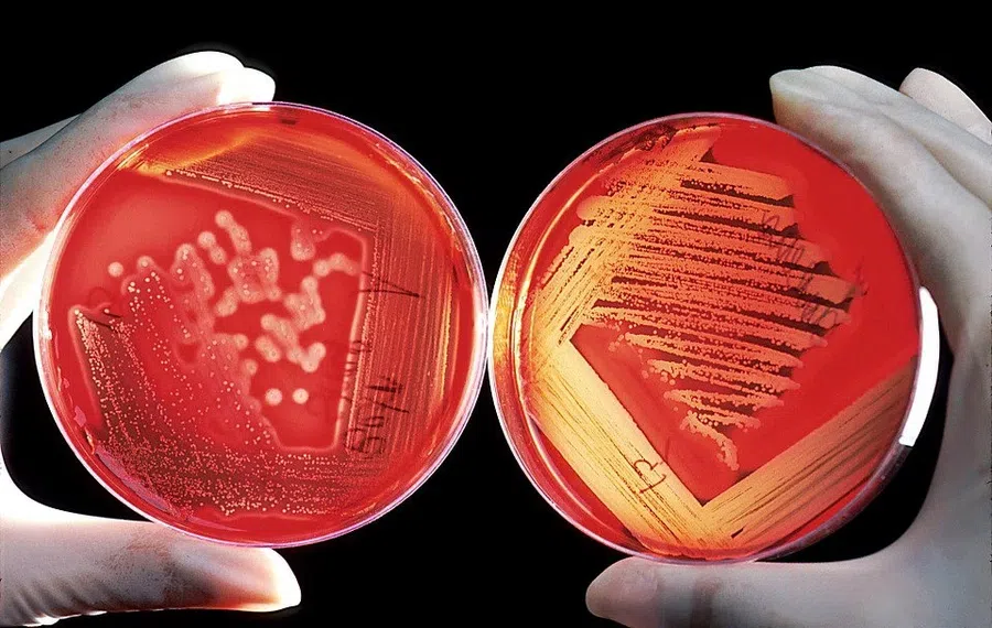 Организм борется с инфекцией двумя «волнами» антител разного вида