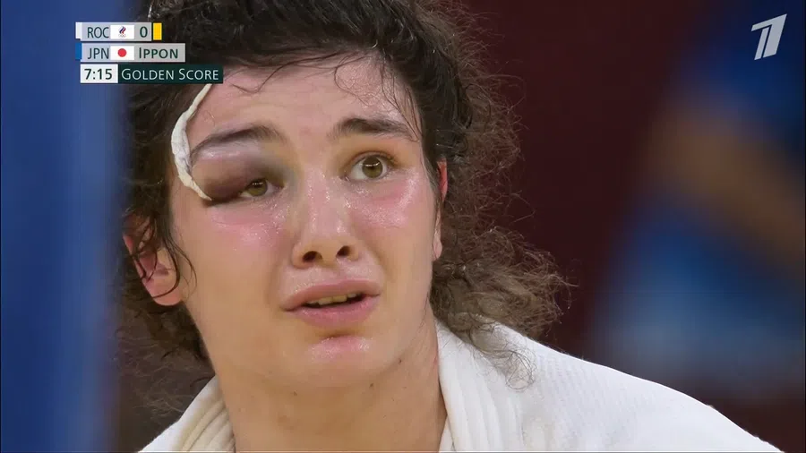 Мадина Таймазова несмотря на страшную гематому завоевала первую для России медаль в дзюдо