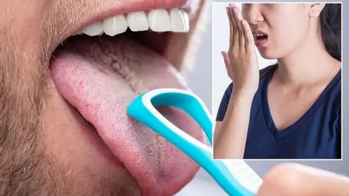 Соскоб языка имеет множество преимуществ для здоровья полости рта. Фото: GETTY