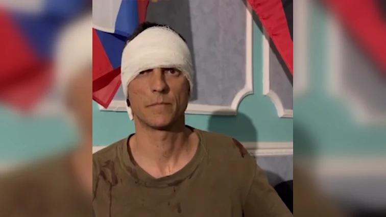 «Боевой дух не сильно на подъеме. Мы не бойцы»: Кадыров показал на видео допрос украинского военнопленного с перемотанной головой и испачканном кровью свитере