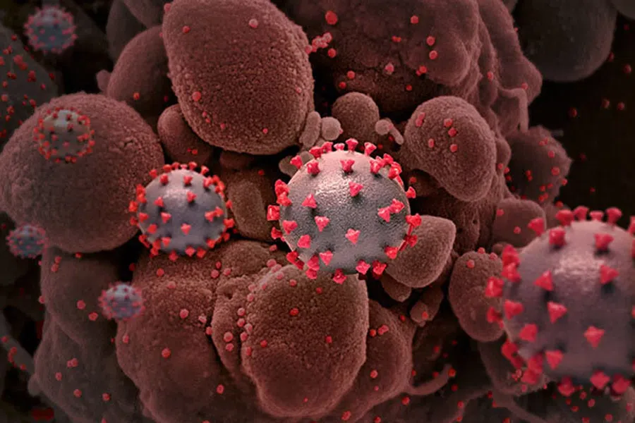 Инфекция коронавируса может подавляться не только антителами человека - что помогает?