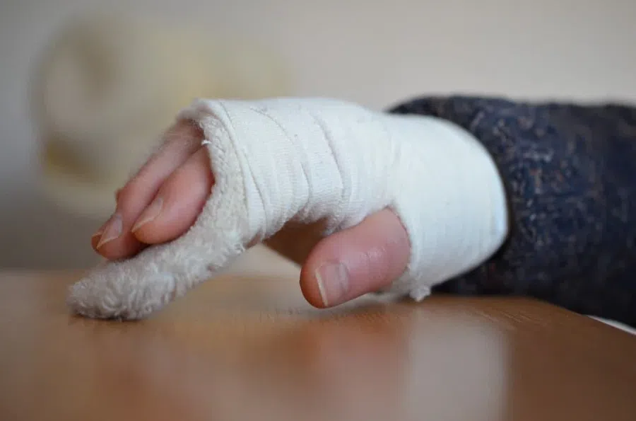 Год прожила со сломанной рукой алтайка: Муж ударил сапогом за оскорбления