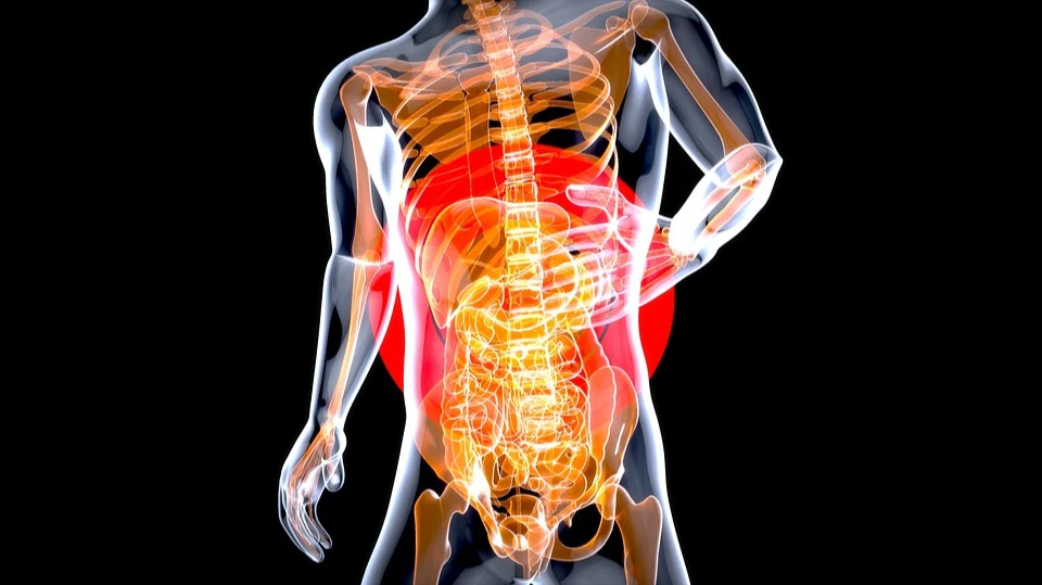 Рак кишечника в топах онкологии. Фото: pixabay.com