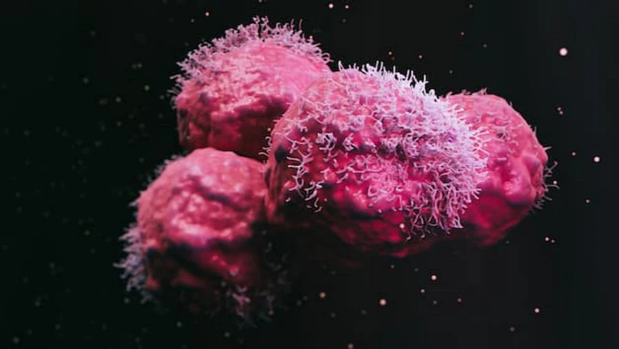 
Немецкие ученые открыли механизм распространения рака молочной железы в организме: клетки-мусорщики создают себе «метастатическую нишу» - главные признаки рака молочной железы 
