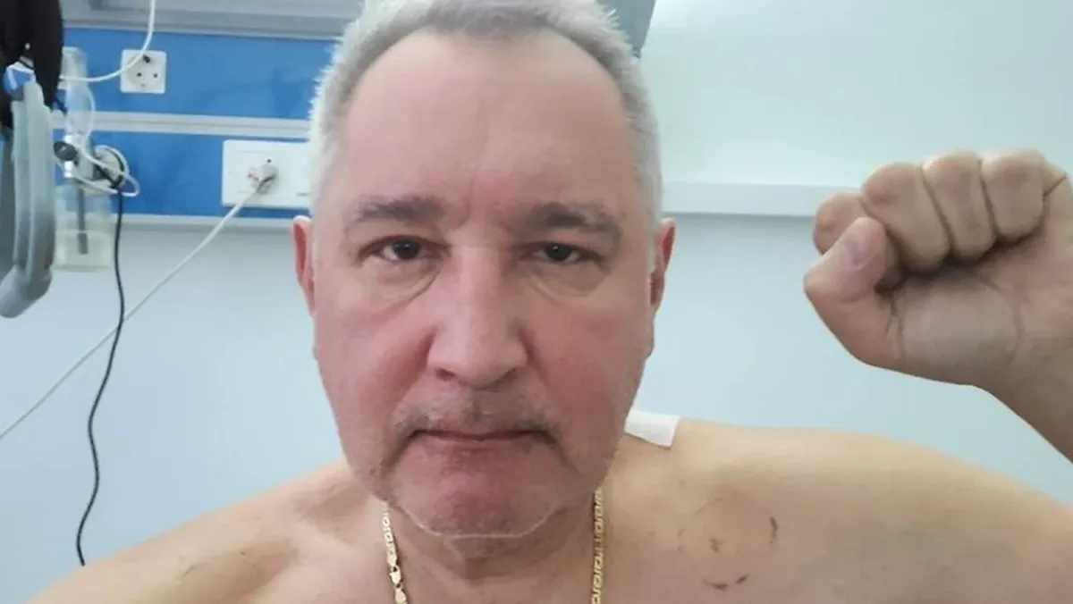 «Готов идти до конца» Как себя чувствует Дмитрий Рогозин после ранения в Донецке – вернется ли обратно в зону СВО