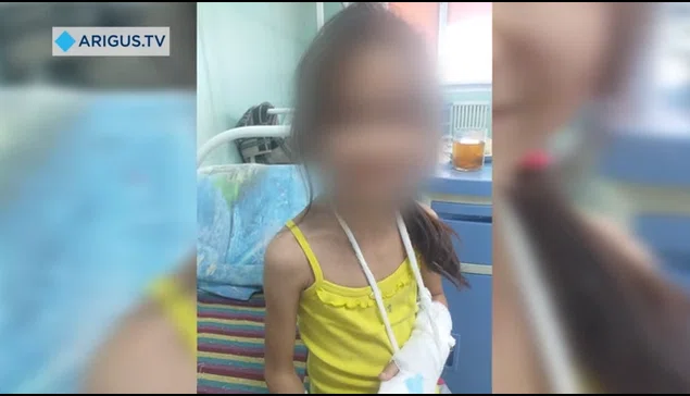 Мать отрезала 8-летней дочери пальцы на руке "из-за шалости"