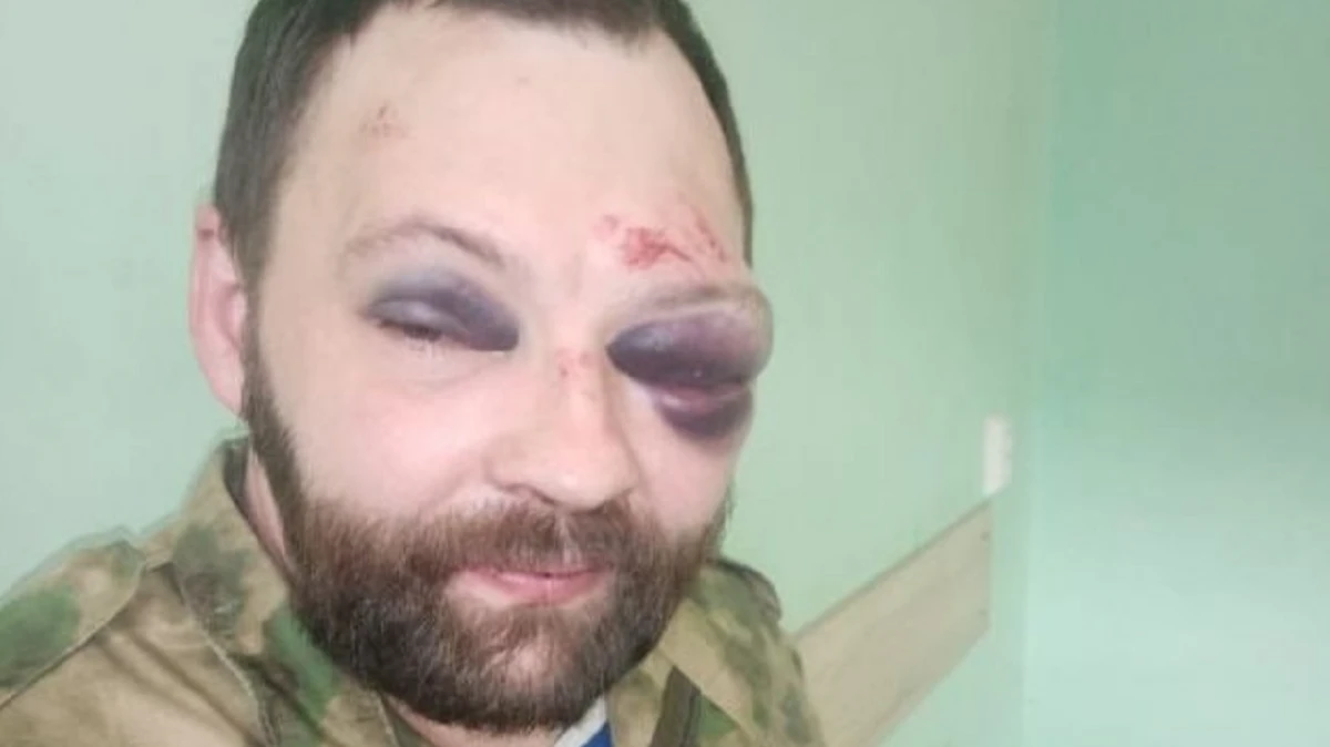 В Ленинградской области бывшего предпринимателя Алексея Лымаря, который вернулся с Донбасса, забили табуреткой в ночном клубе 