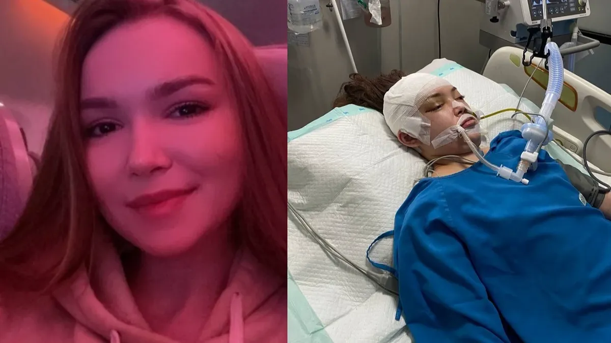 «Перелом черепа» Жительница Новосибирска Анжелика Чудоякова серьезно пострадала в ДТП на Бали