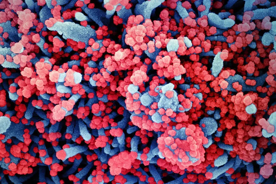 Достоверно оценивать риск смерти от коронавируса научились исследователи