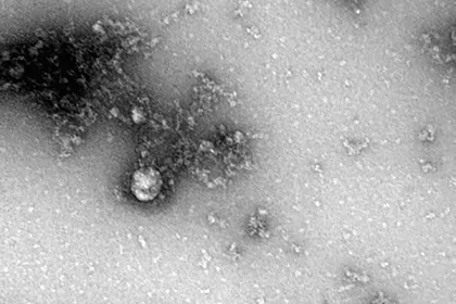 Роспотребнадзор опубликовал первые фото «дельта»-штамма коронавируса