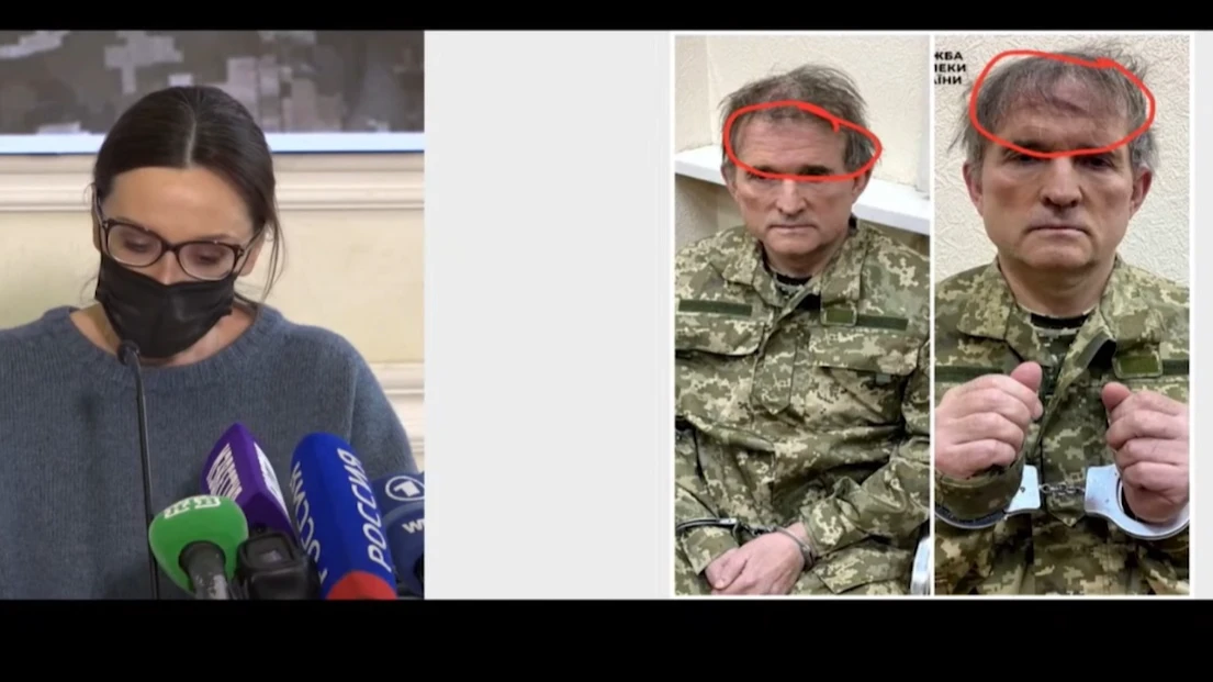 «Синяки прикрыли волосами» Жена кума Путина - Медведчука обвиняла СБУ в пытках