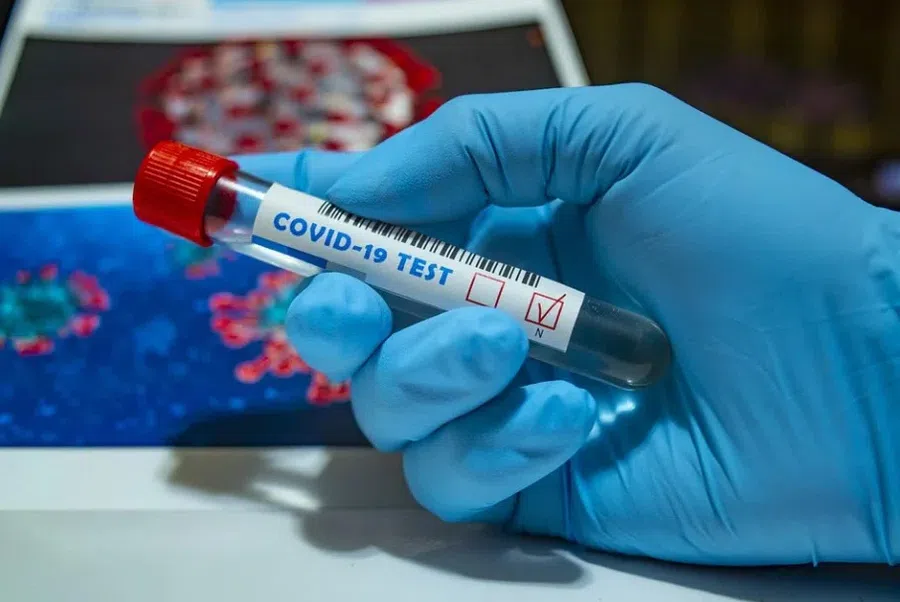 В Бердске выявили 123  новых зараженных коронавирусом за сутки 14 февраля