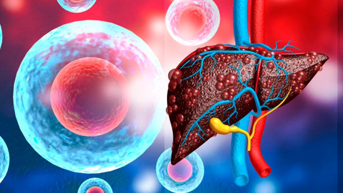 Симптомы рака печени  могут проявлять в желудке: главные причины и признаки онкологии печени