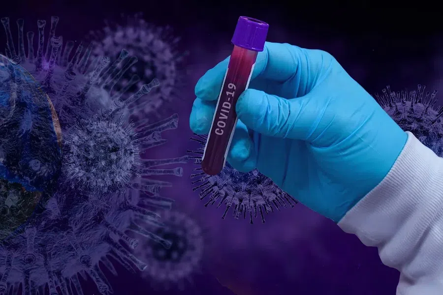 Риск смерти при внутрибольничном заражении коронавирусом выше, чем заразиться в социуме, открытие ученых