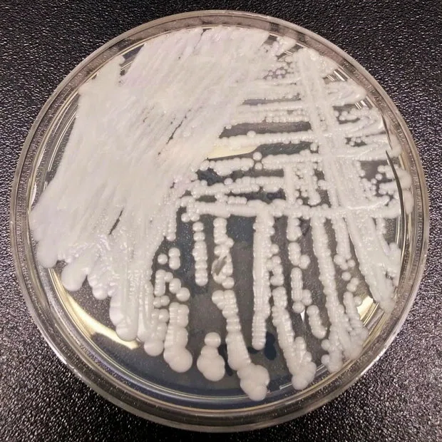 Вспышка редкой лекарственно-устойчивой супербактерии поразила больницу Орегона